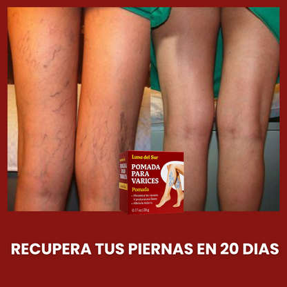 VARITREX OFERTA 2X1 / CREMA ELIMINA VARICES  / ALIVIO EN 20 DIAS / PAGUE 1 RECIBA 2🎁