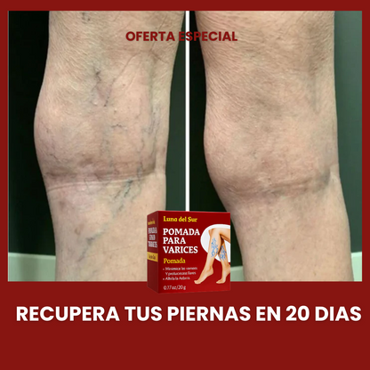 VARITREX OFERTA 2X1 / CREMA ELIMINA VARICES  / ALIVIO EN 20 DIAS / PAGUE 1 RECIBA 2🎁