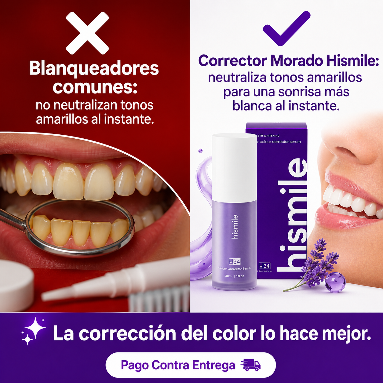 Hismile® | Corrector Dental Morado