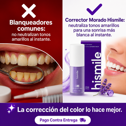Hismile® | Corrector Dental Morado