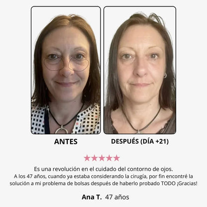 WOMBEA®  Crema de luz roja para el contorno de ojos