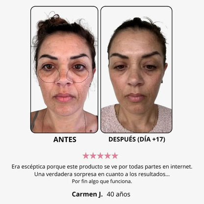 WOMBEA®  Crema de luz roja para el contorno de ojos