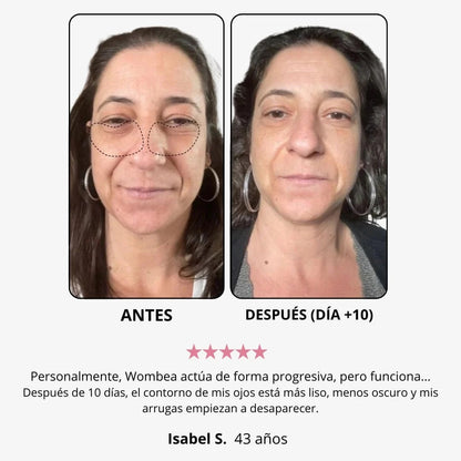 WOMBEA®  Crema de luz roja para el contorno de ojos