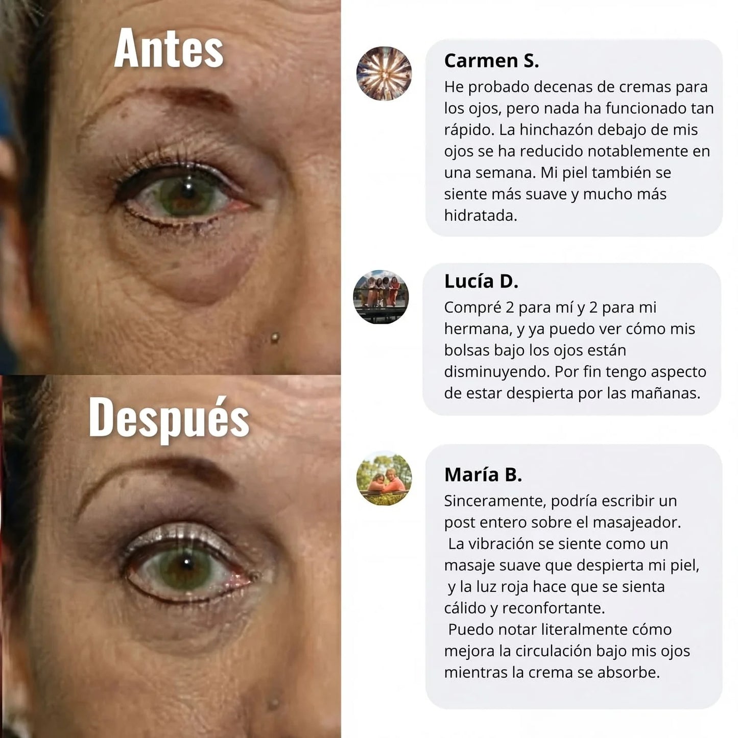 WOMBEA®  Crema de luz roja para el contorno de ojos