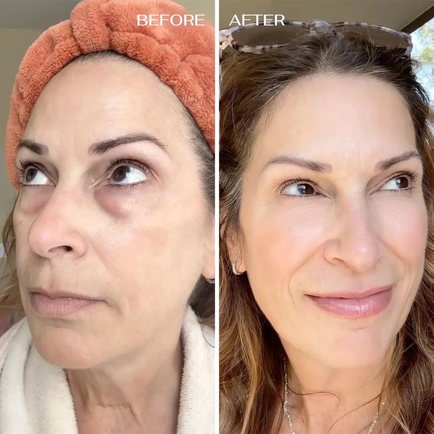 Bioaqua Eye Cream™ Bolsas y Ojeras