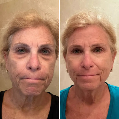 Bioaqua Eye Cream™ Bolsas y Ojeras