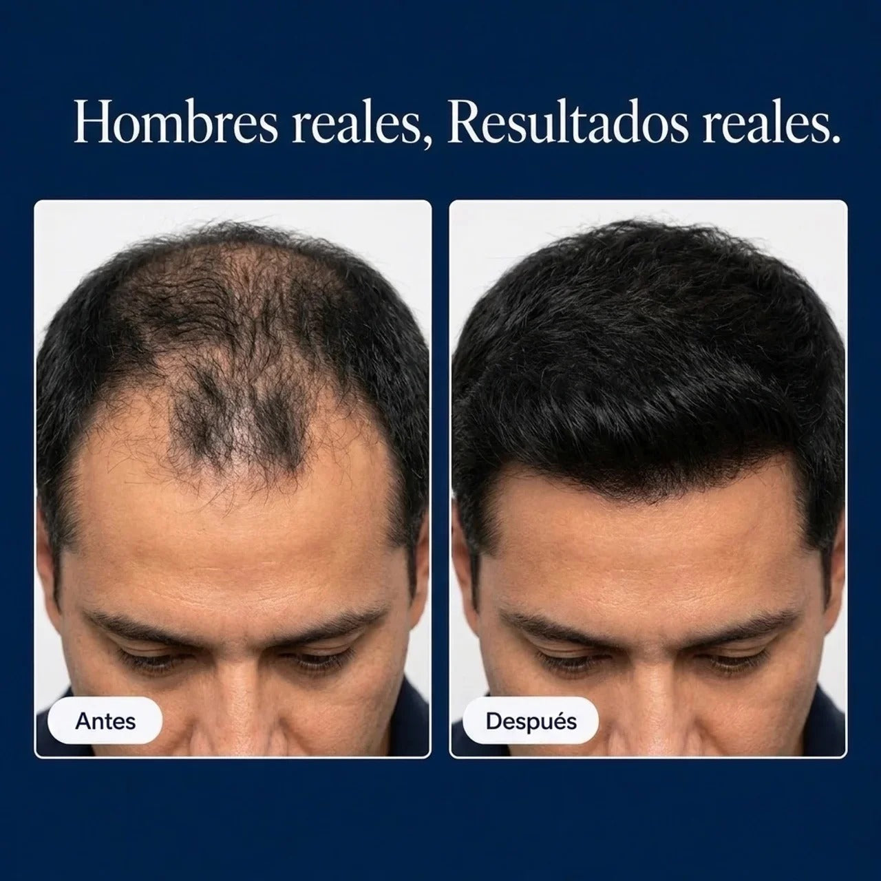 BAVEX HAIR SERUM™ — Sérum Capilar Roll-On
