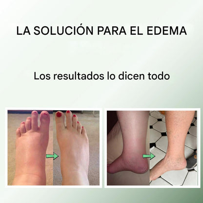 Piernas Ligeras al Instante: Miracle Balm™ Para Piernas y Tobillos Hinchados. 50%OFF